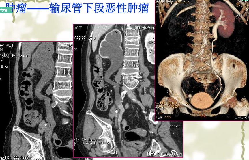 放射科新技術(shù)介紹