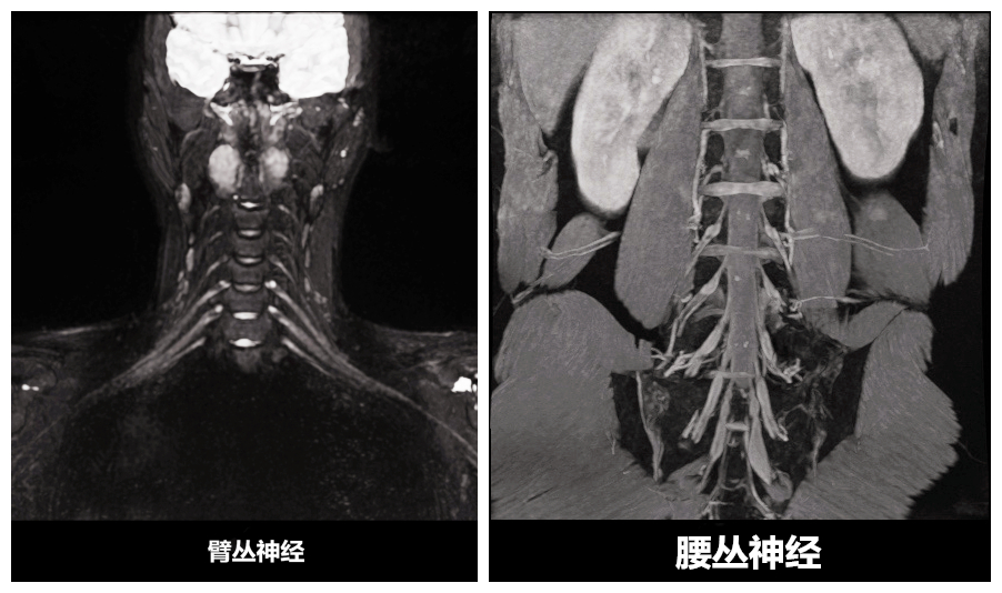 臂叢神經(jīng)_副本.jpg